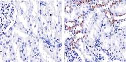 Claudin 10 Polyclonal Antibody:Antibodies, Polyclonal