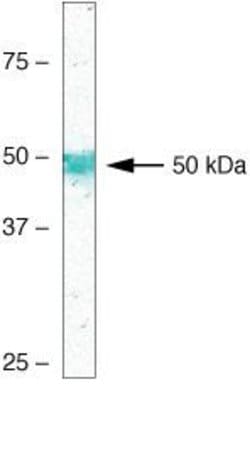 Invitrogen Parkin Monoclonal Antibody (PRK109) 100 &mu;g; Unconjugated:Antibodies,