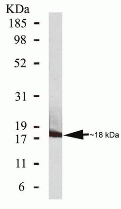 Invitrogen CDKN2C Monoclonal Antibody (ZP001) 100 &mu;g | Buy Online | Invitrogen&trade; | Fisher Scientific