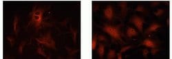 Invitrogen CDKN2C Monoclonal Antibody (ZP001) 100 &mu;g | Buy Online | Invitrogen&trade; | Fisher Scientific