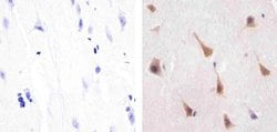 Invitrogen PPP2R5C Monoclonal Antibody (TQ11-1G6) 100 &mu;g; Unconjugated:Antibodies,