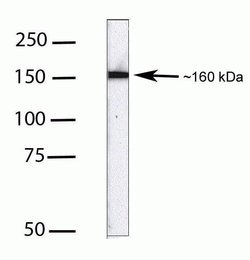 Invitrogen MSH6 Monoclonal Antibody (ZM006) 100 &mu;g; Unconjugated:Antibodies,