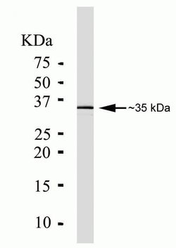 Invitrogen PIM1 Monoclonal Antibody (ZP003) 100 &mu;g; Unconjugated:Antibodies,