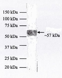 Invitrogen Cytokeratin 10 Monoclonal Antibody (VIK-10) 100 &mu;g; Unconjugated:Antibodies,
