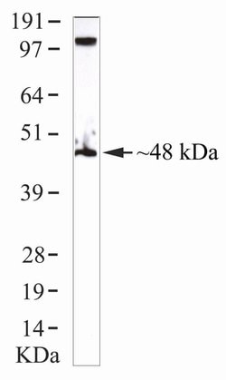 Invitrogen IRF8 Monoclonal Antibody (ZI003) 100 &mu;g; Unconjugated:Anticuerpos