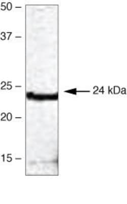 HOXB7 Polyclonal Antibody:Antibodies, Polyclonal