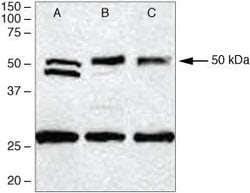 Invitrogen PDGF-D Polyclonal Antibody 100 &mu;g; Unconjugated:Antibodies,