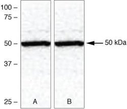 Invitrogen&trade;&nbsp;TXNIP Polyclonal Antibody