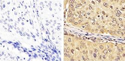 Invitrogen FBXW7 Polyclonal Antibody 100 &mu;g; Unconjugated:Antibodies,