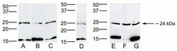 HOXB7 Polyclonal Antibody:Antibodies, Polyclonal