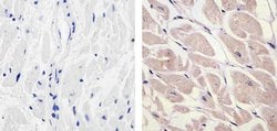 Invitrogen PDGF-D Polyclonal Antibody 100 &mu;g; Unconjugated:Antibodies,