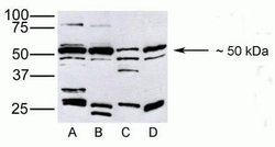 Invitrogen PDGF-D Polyclonal Antibody 100 &mu;g; Unconjugated:Antibodies,