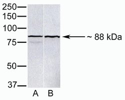Invitrogen PARP9 Polyclonal Antibody 100 &mu;g; Unconjugated:Antibodies,