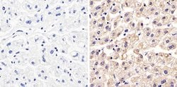 Invitrogen Occludin Polyclonal Antibody 100 &mu;g | Buy Online | Invitrogen&trade; | Fisher Scientific
