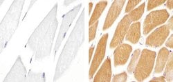 Invitrogen JPH1 Polyclonal Antibody 100 &mu;g; Unconjugated:Antibodies,