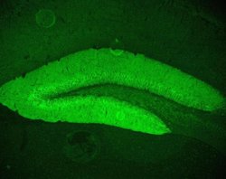 Invitrogen JPH1 Polyclonal Antibody 100 &mu;g; Unconjugated:Antibodies,