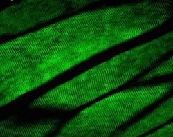 Invitrogen JPH2 Polyclonal Antibody 100 &mu;g | Buy Online | Invitrogen&trade; | Fisher Scientific