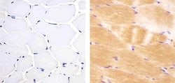 Invitrogen JPH2 Polyclonal Antibody 100 &mu;g | Buy Online | Invitrogen&trade; | Fisher Scientific