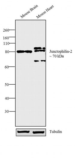 Invitrogen JPH2 Polyclonal Antibody 100 &mu;g | Buy Online | Invitrogen&trade; | Fisher Scientific