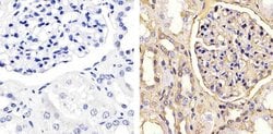 Invitrogen Occludin Polyclonal Antibody 100 &mu;g; Unconjugated:Antibodies,