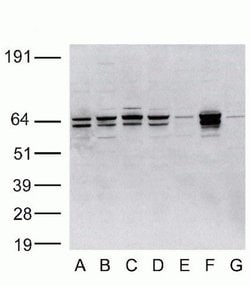 Invitrogen Metadherin Polyclonal Antibody 100 &mu;g; Unconjugated:Antibodies,
