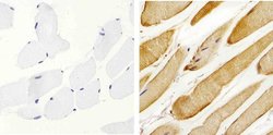 Invitrogen Metadherin Polyclonal Antibody 100 &mu;g; Unconjugated:Antibodies,