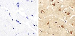 ANGPTL4 Polyclonal Antibody, Invitrogen 100 &mu;g; Unconjugated:Antibodies,