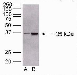 ANGPTL4 Polyclonal Antibody, Invitrogen 100 &mu;g; Unconjugated:Antibodies,