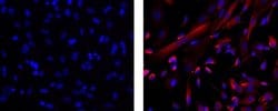 Invitrogen Nestin Monoclonal Antibody (10C2), eFluor 570, eBioscience 25