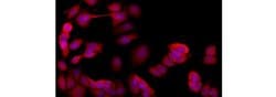 Cytokeratin 19 Monoclonal Antibody (BA17), eFluor 570, eBioscience , Invitrogen:Antibodies:Primary