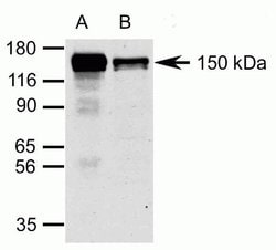 Invitrogen Raptor Polyclonal Antibody 100 &mu;g; Unconjugated:Antibodies,