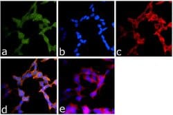 Invitrogen CYLD Monoclonal Antibody (733) 100 &mu;g; Unconjugated:Antibodies,