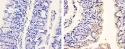 Invitrogen Phospho-PDGFRA (Tyr754) Polyclonal Antibody 100 &mu;L; Unconjugated:Antibodies,
