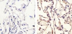 Invitrogen Phospho-Paxillin (Ser178) Polyclonal Antibody 100 &mu;L; Unconjugated:Antibodies,