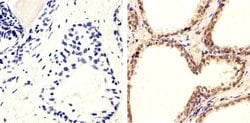 Invitrogen Phospho-PTEN (Ser370) Polyclonal Antibody 100 &mu;L; Unconjugated:Antibodies,
