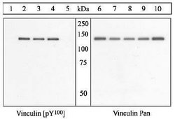 Invitrogen Phospho-Vinculin (Tyr100) Polyclonal Antibody 100 &mu;L | Buy Online | Invitrogen&trade; | Fisher Scientific