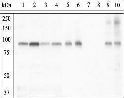 Invitrogen Phospho-GYS1 (Ser641, Ser645) Polyclonal Antibody 100 &mu;L;