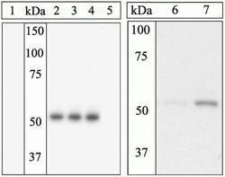 Phospho-ETS1 (Ser282) Polyclonal Antibody, Invitrogen 100 &mu;L | Buy Online | Invitrogen | Fisher Scientific