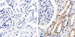 Invitrogen Phospho-FGFR1 (Tyr653, Tyr654) Polyclonal Antibody 100 &mu;L;