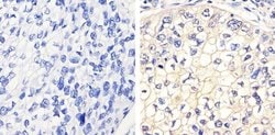 Invitrogen Phospho-FGFR1 (Tyr653, Tyr654) Polyclonal Antibody 100 &mu;L;