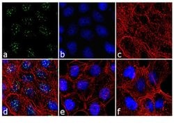 Invitrogen Phospho-PPP1R2 (Thr72) Polyclonal Antibody 100 &mu;L; Unconjugated:Antibodies,