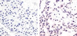 Invitrogen Phospho-MDM2 (Ser166) Polyclonal Antibody 100 &mu;L; Unconjugated:Antibodies,
