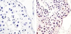 Invitrogen Phospho-MDM2 (Ser166) Polyclonal Antibody 100 &mu;L; Unconjugated:Antibodies,