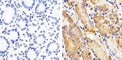 Invitrogen Phospho-RAC1/CDC42 (Ser71) Polyclonal Antibody 100 &mu;L; Unconjugated:Antibodies,