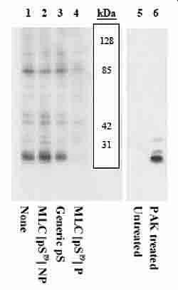 Invitrogen Phospho-MYLK (Ser19) Polyclonal Antibody 100 &mu;L; Unconjugated:Antibodies,