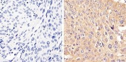 Invitrogen STAT2 Polyclonal Antibody 100 &mu;L; Unconjugated:Antibodies,