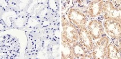 Invitrogen STAT2 Polyclonal Antibody 100 &mu;L; Unconjugated:Antibodies,
