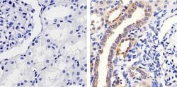 Invitrogen Phospho-MEK1 (Ser298) Polyclonal Antibody 100 &mu;L; Unconjugated:Antibodies,