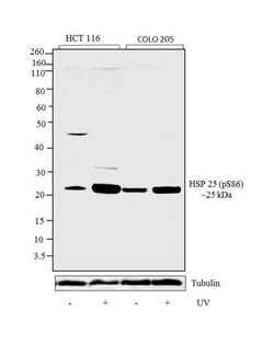 Invitrogen Phospho-HSP25 (Ser86) Polyclonal Antibody 100 &mu;L | Buy Online | Invitrogen&trade; | Fisher Scientific