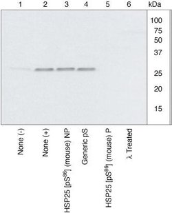 Invitrogen Phospho-HSP25 (Ser86) Polyclonal Antibody 100 &mu;L | Buy Online | Invitrogen&trade; | Fisher Scientific